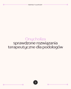 Onycholiza - sprawdzone rozwiązania terapeutyczne